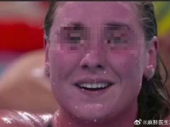 关于米国游泳队人均“紫脸”这事儿,一直有些猜想-黑榜